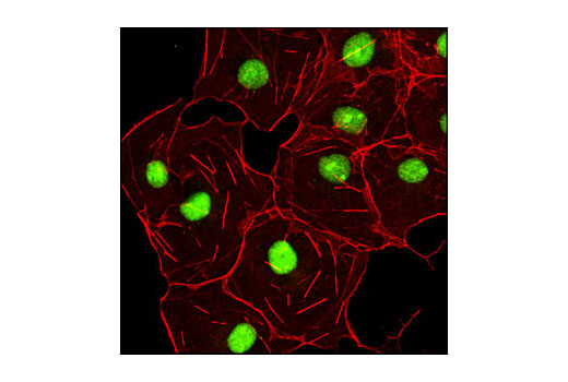 Confocal immunofluorescent analysis of COS cells using HMGB1 Antibody (green). Actin filaments were labeled using DY-554 phalloidin (red).