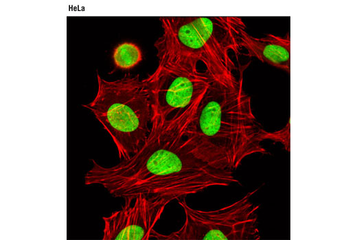 Confocal immunofluorescent analysis of HeLa cells using HMGN2 (D9B9) XP ® Rabbit mAb (green). Actin filaments were labeled with DY-554 phalloidin (red).
