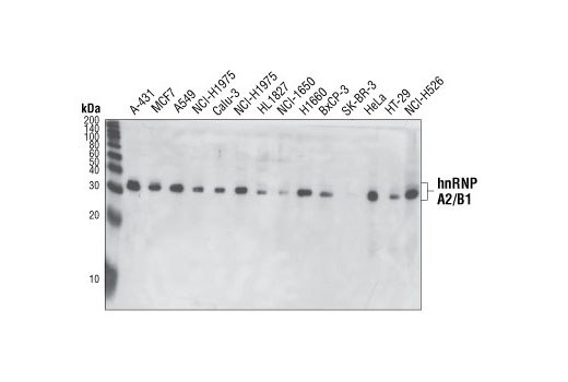 Western blot analysis of extracts from various cell lines using hnRNP A2/B1 (2A2) Mouse mAb.