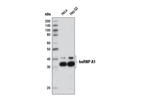 Western blot analysis of extracts from various cell lines using hnRNP A1 (D21H11) Rabbit mAb.