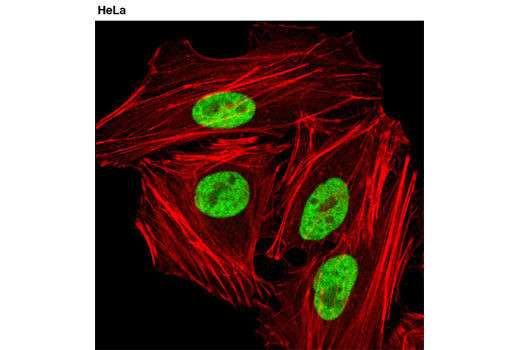 Confocal immunofluorescent analysis of HeLa cells using hnRNP A1 (D21H1) Rabbit mAb (green). Actin filaments were labeled with DY-554 phalloidin (red).