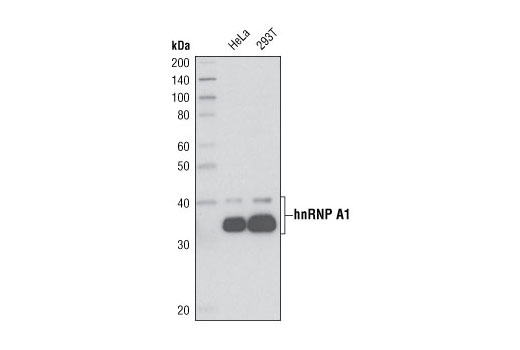 Western blot analysis of extracts from HeLa and 293T cells using hnRNP A1 (R196) Antibody.