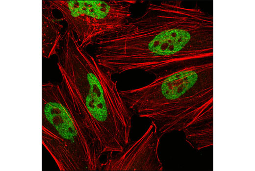 Confocal immunofluorescent analysis of HeLa cells using hnRNP A1 (R196) Antibody (green). Actin filaments have been labeled with DY-554 phalloidin (red).