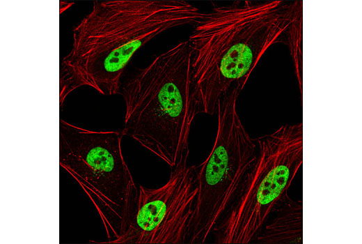 Confocal immunofluorescent analysis of HeLa cells using hnRNP A1 (K350) Antibody (green). Actin filaments have been labeled with DY-554 phalloidin (red).