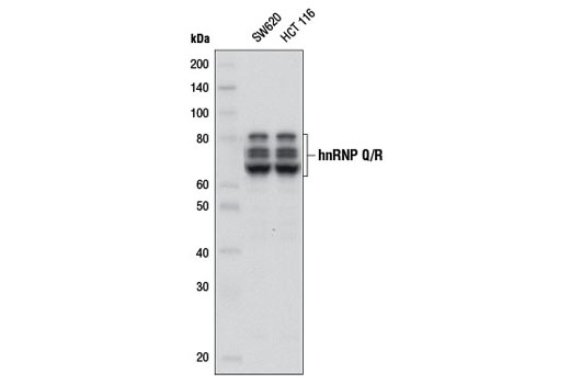 Western blot analysis of extracts from SW620 and HCT 116 cells using hnRNP Q/R (D18B2) Rabbit mAb.
