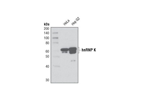 Western blot analysis of extracts from HeLa and Hep G2 cells using hnRNP K (R332) Antibody.
