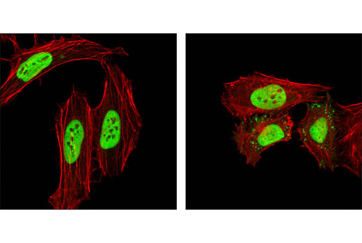 Confocal immunofluorescent analysis of HeLa cells, untreated (left) or UV-treated (right), using hnRNP K (R332) Antibody (green). Actin filaments have been labeled with DY-554 phalloidin (red).