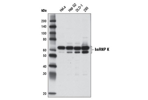 Western blot analysis of extracts from various cell lines using hnRNP K (D9A8) Rabbit mAb.