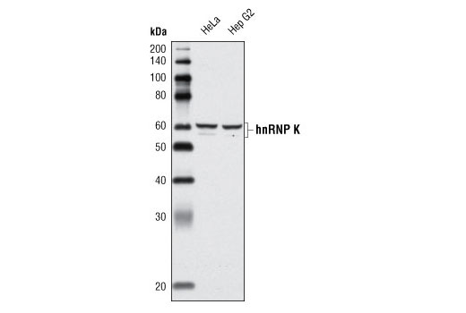 Western blot analysis of extracts from HeLa and Hep G2 cells using hnRNP K (A222) Antibody.
