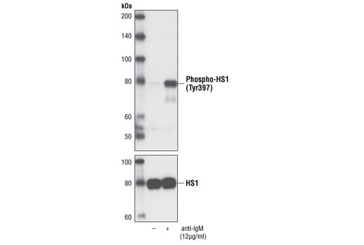 Western blot analysis of total extracts from Ramos cells, serum-starved for 2 hours and treated with anti-IgM antibody for 10 minutes, using Phospho-HS1 (Tyr397) Antibody (upper) or HS1 Antibody (Human Specific) #4503 (lower).