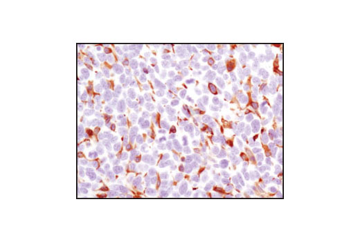 Immunohistochemical analysis of paraffin-embedded LL2 syngeneic tumor using HS1 (D5A9) XP ® Rabbit mAb (Rodent Specific).