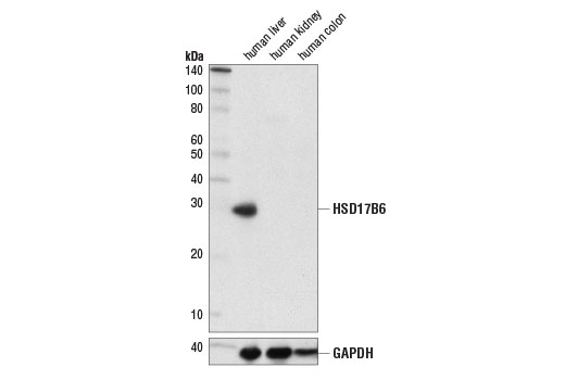 Western blot analysis of extracts from human liver (positive), kidney (negative), and colon (negative) tissues using HSD17B6 (D1T5H) Rabbit mAb (upper) and GAPDH (D16H11) XP ® Rabbit mAb #5174 (lower).