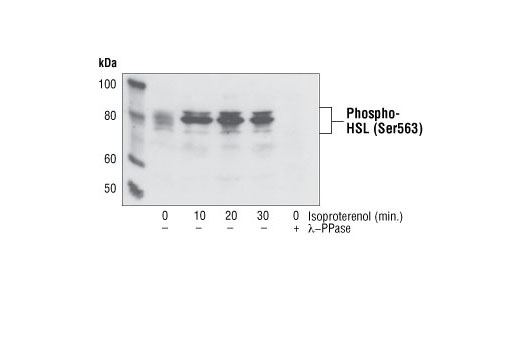 Western blot analysis of extracts from differentiated 3T3-L1 cells treated with isoproterenol or lambda protein phosphatase, using Phospho-HSL (Ser563) Antibody.