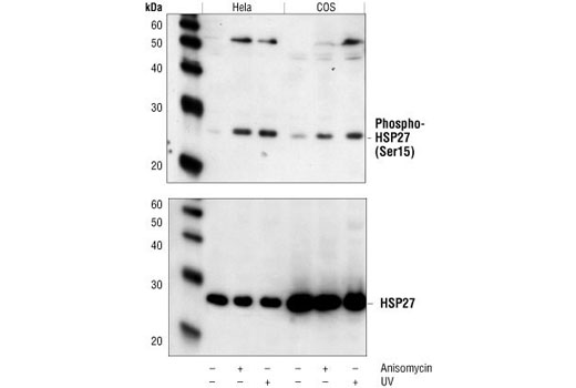 Western blot analysis of extracts from HeLa and COS cells, untreated, anisomycin-treated or UV-treated, using Phospho-HSP27 (Ser15) Antibody (upper) or HSP27 (G31) Monoclonal Antibody #2402 (lower).