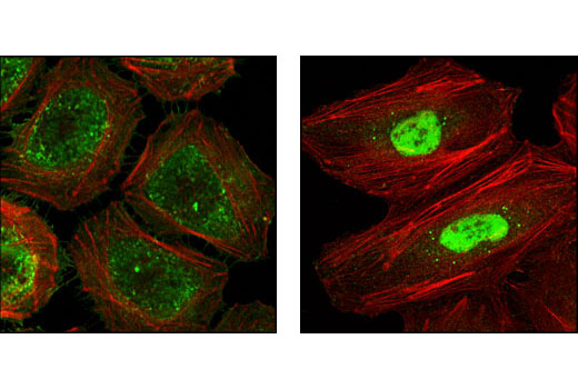 Confocal immunofluorescent analysis of HeLa cells, untreated (left) or heat-treated (right), using HSP40 Antibody (green). Actin filaments have been labeled with Alexa Fluor® 555 phalloidin (red).