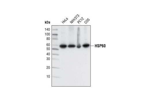 Western blot analysis of extracts from various cell types using HSP60 (D85) Antibody.