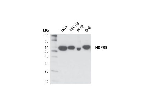 Western blot analysis of extracts from various cell types using HSP60 (D307) Antibody.