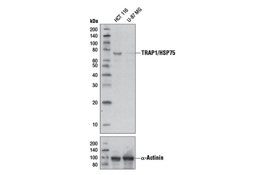 Western blot analysis of extracts from HCT 116 and U-87 MG cells using TRAP1/HSP75 Antibody (upper) and α-Actinin (D6F6) XP ® Rabbit mAb #6487 (lower).