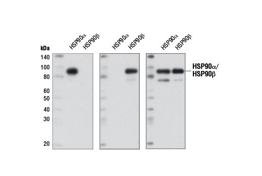 Western blot analysis of recombinant HSP90α and HSP90β purified from S. frugiperda (1 μg) using HSP90α (D1A7) Rabbit mAb (left panel), HSP90β (D3F2) Rabbit mAb #7411 (center panel), or HSP90 Antibody #4874 (right panel).