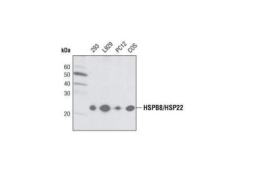 Western blot analysis of extracts from various cell lines using HSPB8/HSP22 Antibody.