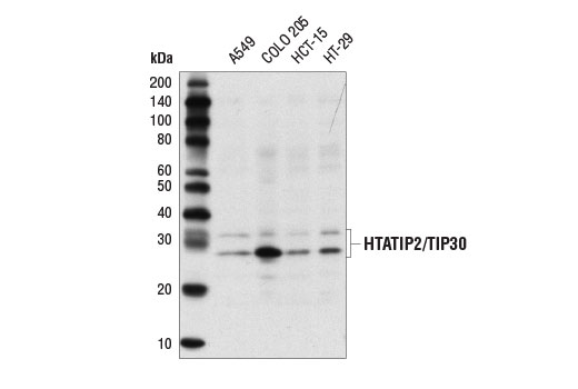 Western blot analysis of extracts from various cell lines using HTATIP2/TIP30 Antibody.