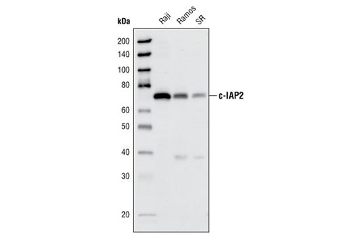 Western blot analysis of extracts from Raji, Ramos and SR cell lines, using c-IAP2 (58C7) Rabbit mAb.