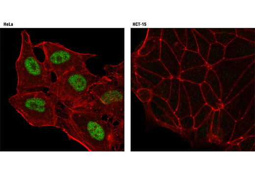 Confocal immunofluorescent analysis of HeLa (positive; left) and HCT-15 (negative; right) cells using ID3 (D16D10) Rabbit mAb (green). Actin filaments were labeled with DY-554 phalloidin (red).
