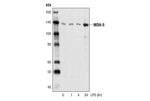 Western blot anlaysis of extracts from differentiated THP-1 cells, untreated or treated with LPS (1 μg/ml, indicated times), using MDA-5 (D74E4) Rabbit mAb.