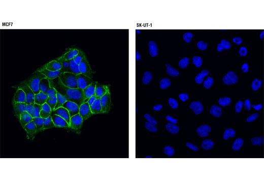 Confocal immunofluorescent analysis of MCF7 (left) and SK-UT-1 (right) cells using IGF-I Receptor β (D23H3) XP ® Rabbit mAb (green). Blue pseudocolor = DRAQ5 ® #4084 (fluorescent DNA dye).
