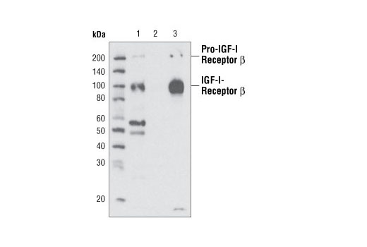 Immunoprecipitation of IGF-I Receptor beta from untreated mIMCD3 cell extracts using IGF-I Receptor beta (111A9) Rabbit mAb (Lane 1). Lane 2: No antibody control. Lane 3: Input control.