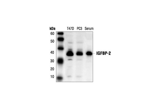 Western blot analysis of extracts from T-47D and PC-3 cells and human serum using IGFBP2 Antibody.