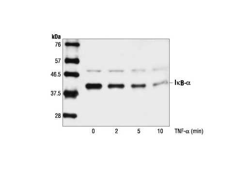 Western blot analysis of extracts from HeLa cells treated with TNF-α (#2169, 20 ng/ml) for the indicated times, using