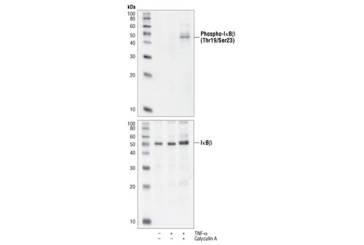 Western blot analysis of extracts from HT-29 cells treated with TNF-α (#2169, 20 ng/ml) and calyculin A (#9902, 100 nM) for 10 minutes as indicated, using Phospho-IκBβ (Thr19/Ser23) Antibody (upper) or IκBβ Antibody #9248 (lower).