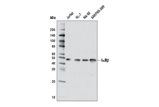 Western blot analysis of extracts from various cell lines using IκBβ (7B4) Mouse mAb.