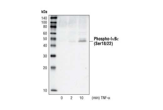 Western blot analysis of extracts from 293 cells treated with TNF-α (20 ng/ml) for the indicated times, using Phospho-IκBε (Ser18/22) Antibody.