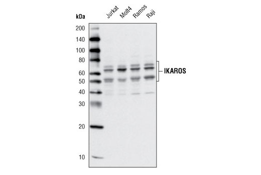 Western analysis of extracts from various cell lines using Ikaros Antibody.
