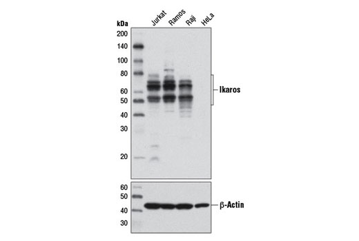 Western blot analysis of extracts from various cell lines using Ikaros (D10E5) Rabbit mAb (upper) or β-actin (D6A8) Rabbit mAb #8457 (lower). Western blot results confirm absence of detectable Ikaros protein in HeLa cells, in accordance with the immunofluorescence analysis.