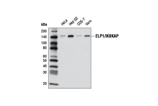 Western blot analysis of extracts from various cell lines using ELP1/IKBKAP Antibody.