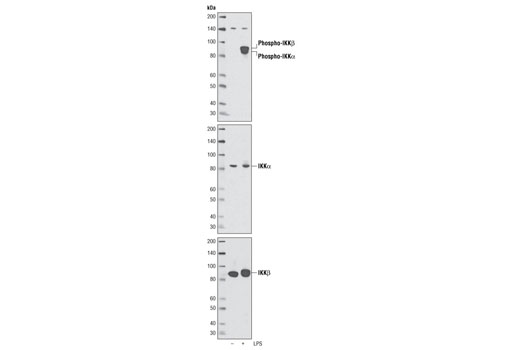 Western blot analysis of extracts from differentiated THP-1 cells, untreated or LPS-treated for 15 minutes, using Phospho-IKKα (Ser176)/IKKβ (Ser177) (C84E11) Rabbit mAb (upper), IKKα Antibody #2682 (middle) and IKKβ (2C8) Rabbit mAb #2370 (lower).