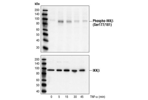 Western blot analysis of extracts from HeLa cells, treated with TNF-α for the indicated times, using Phospho-IKKα/β (Ser176/180) Antibody II (upper) or IKKβ Antibody #2684 (lower).