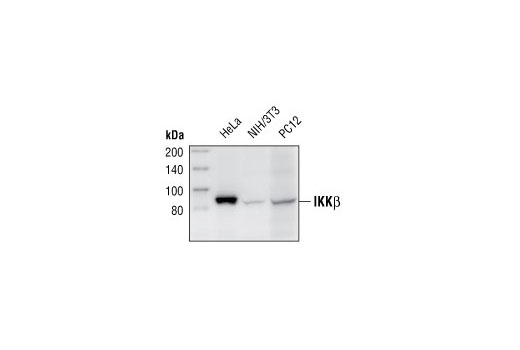 Western blot analysis of extracts from HeLa, NIH/3T3 and PC-12 cells using IKKβ (2C8) Rabbit mAb.