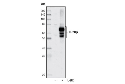 Western blot analysis of extracts from 293T cells, mock transfected (-) or transfected with a human IL-2Rβ construct (+), using IL-2Rβ Antibody.