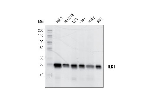 Western blot analysis of cell extracts from various cell lines, using ILK1 (4G9) Rabbit mAb.