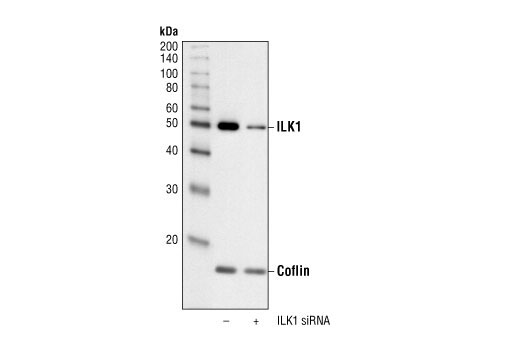 Western blot analysis of extracts from HeLa cells transfected with 50 nM non-targeted siRNA (-) or 100 nM ILK1 siRNA (+), using ILK1 Antibody #3862 and Cofilin Antibody #3312. The ILK1 Antibody confirms silencing of ILK1 expression, and the Cofilin Antibody controls for protein loading and ILK1 siRNA specificity.
