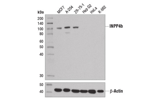 Western blot analysis of extracts from various cell lines using INPP4b (D9K1B) XP ® Rabbit mAb (upper) and β-Actin (D6A8) Rabbit mAb #8457 (lower).