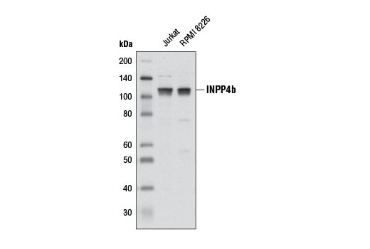 Western blot analysis of extracts from Jurkat and RPMI 8226 cells using INPP4b (D19B9) Rabbit mAb.