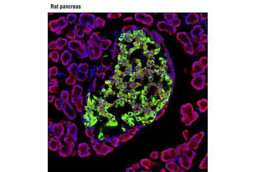 Confocal immunofluorescent analysis of rat pancreas using Insulin (L6B10) Mouse mAb (green) and S6 Ribosomal Protein (5G10) Rabbit mAb #2217 (red). Blue pseudocolor = DRAQ5 ® #4084 (fluorescent DNA dye).