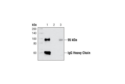 Immunprecipitation of Insulin Receptor beta from insulin treated mIMCD-3 cell extracts using Insulin Receptor beta antibody (Lane 1) Lane 2: No antibody control. Lane 3: Input control.