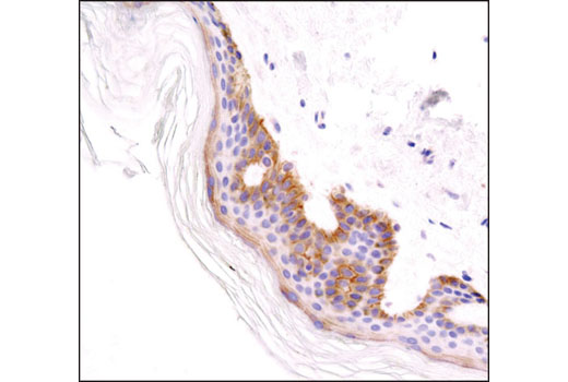 Immunohistochemical analysis of paraffin-embedded human skin using Integrin β1 (D2E5) Rabbit mAb.