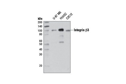 Western blot analysis of extracts from U-87 MG, HUVEC and C2C12 cell lines using Integrin β3 (D7X3P) XP ® Rabbit mAb.